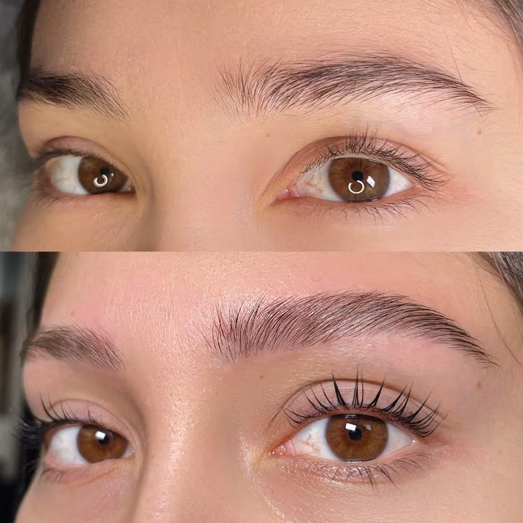 Antes y después de un combo de lifting y laminado en el Estudio Antonella Paludi
