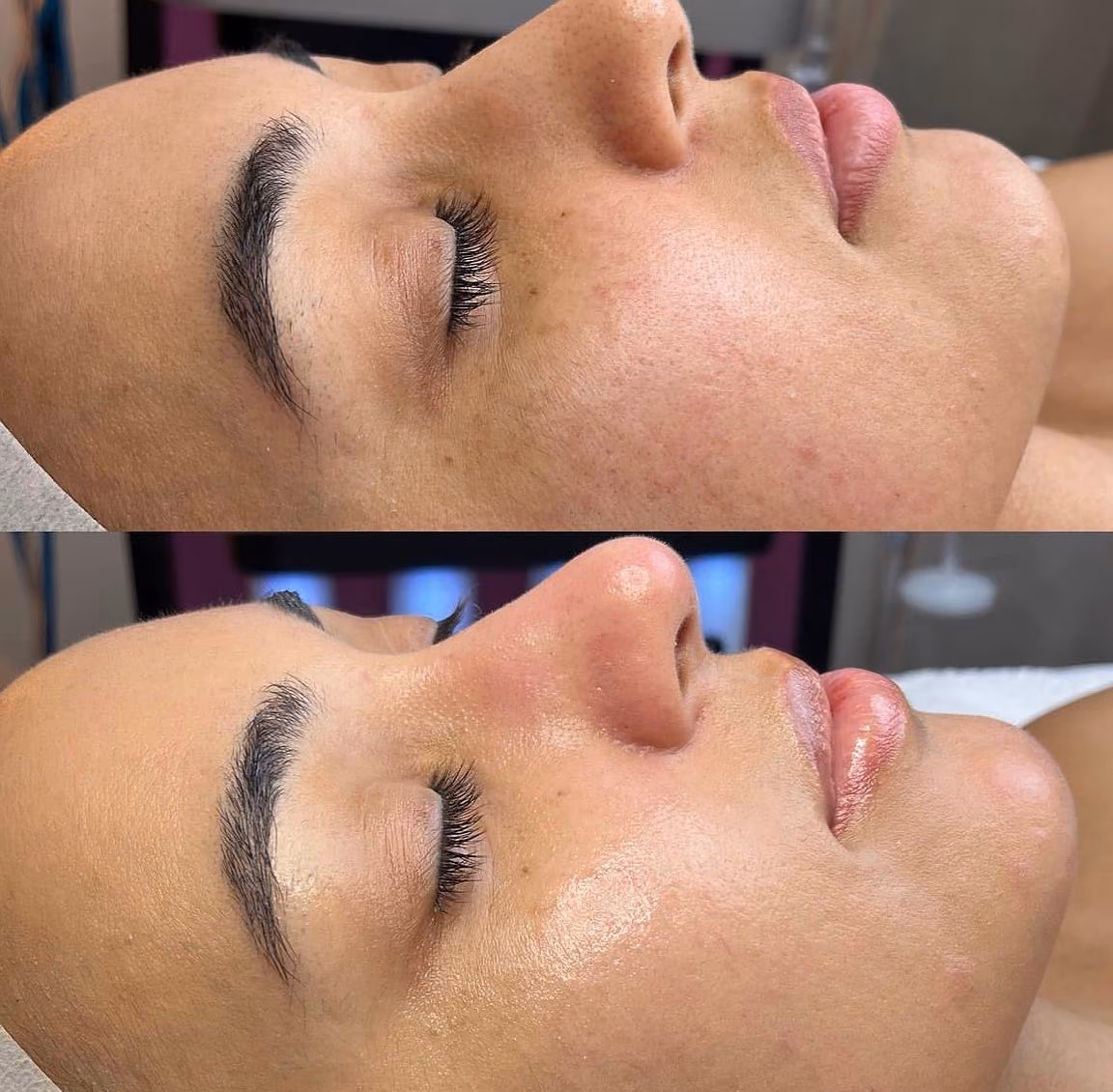 Limpieza facial en proceso en el Estudio Antonella Paludi