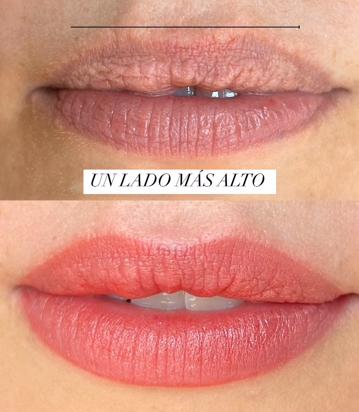 Corrección de labios asimétricos con micropigmentación en el Estudio Antonella Paludi