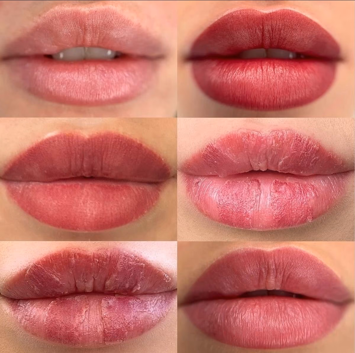 Proceso de cicatrización de una micropigmentación de labios en el Estudio Antonella Paludi